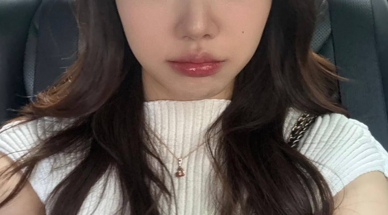 BJアルム♥️